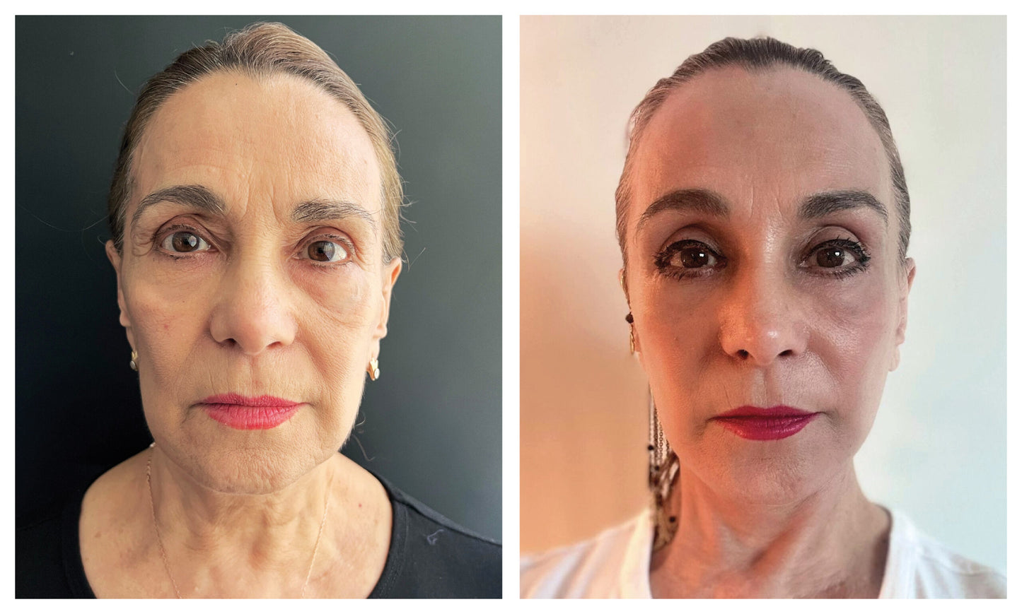 ⚡ RESVERATROL + NAD+ + NAC – Energía Celular, Juventud y Protección en una Fórmu